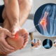 Bone Spurs